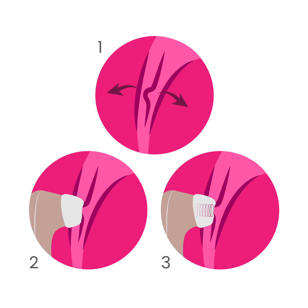 Satisfyer Pro 2 Estimulador De Clítoris - Sen Fantasy